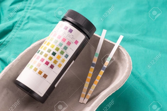 BIOWAY brand urine test strips reader medical urine analyzer / diagnostic test reader/ medical laboratory supplier